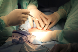 scalpel